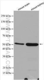 ILK Antibody in Western Blot (WB)