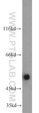 ILK Antibody in Western Blot (WB)