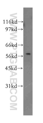 ILK Antibody in Western Blot (WB)