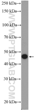 LIPA Antibody in Western Blot (WB)