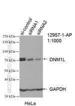 DRP1 (C-terminal) Antibody in Western Blot (WB)