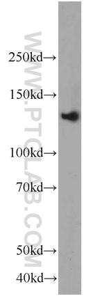 RASGRF1 Antibody in Western Blot (WB)