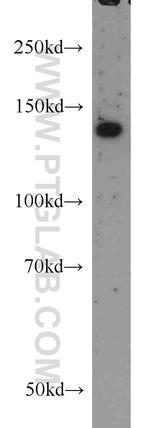 RASGRF1 Antibody in Western Blot (WB)