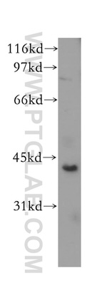 CHAD Antibody in Western Blot (WB)