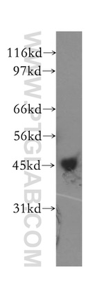 CHAD Antibody in Western Blot (WB)