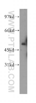 ACP6 Antibody in Western Blot (WB)