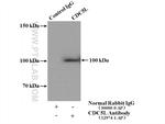 CDC5L Antibody in Immunoprecipitation (IP)