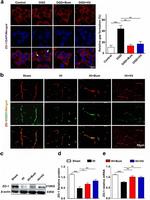 CD31 Antibody in Immunohistochemistry (IHC)