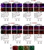 CRTH2 Antibody in Immunocytochemistry (ICC/IF)