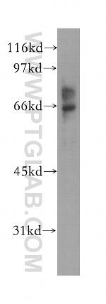 EME1 Antibody in Western Blot (WB)