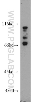 EME1 Antibody in Western Blot (WB)