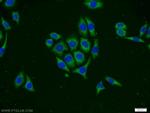 PHD1 Antibody in Immunocytochemistry (ICC/IF)