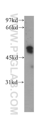 PHD1 Antibody in Western Blot (WB)