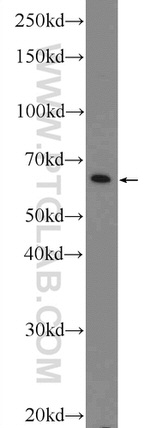 Lamin B1 Antibody in Western Blot (WB)