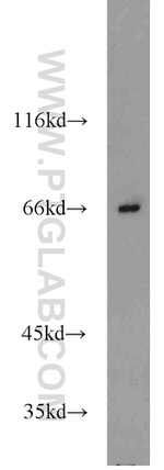 Lamin B1 Antibody in Western Blot (WB)