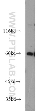 Lamin B1 Antibody in Western Blot (WB)