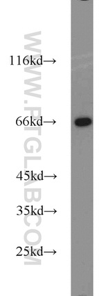 Lamin B1 Antibody in Western Blot (WB)