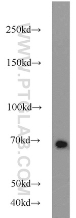 Lamin B1 Antibody in Western Blot (WB)