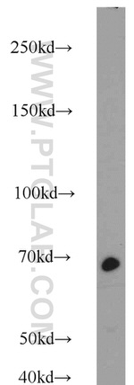 Lamin B1 Antibody in Western Blot (WB)