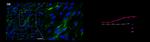 Transferrin Receptor Antibody in Flow Cytometry (Flow)