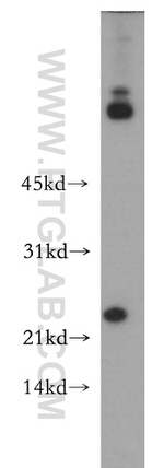 ARMER Antibody in Western Blot (WB)