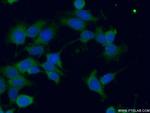 GSPT2 Antibody in Immunocytochemistry (ICC/IF)