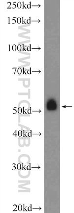 NEU4 Antibody in Western Blot (WB)