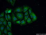 NF-L Antibody in Immunocytochemistry (ICC/IF)