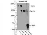 NF-L Antibody in Western Blot (WB)