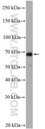 NF-L Antibody in Western Blot (WB)