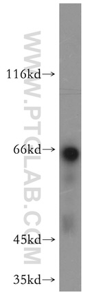 NF-L Antibody in Western Blot (WB)