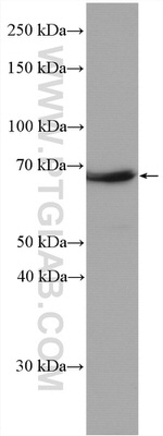 NF-L Antibody in Western Blot (WB)