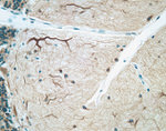 MAP2 Antibody in Immunohistochemistry (IHC)