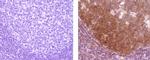 Mouse IgG (H+L) Secondary Antibody in Immunohistochemistry (Paraffin) (IHC (P))