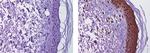 Mouse IgG (H+L) Secondary Antibody in Immunohistochemistry (Paraffin) (IHC (P))