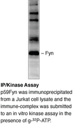 Fyn Antibody in Western Blot (WB)