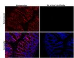 beta Catenin Antibody in Immunohistochemistry (Paraffin) (IHC (P))