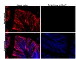 beta Catenin Antibody in Immunohistochemistry (Paraffin) (IHC (P))