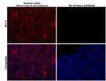 Bcl-2 Antibody in Immunohistochemistry (Paraffin) (IHC (P))