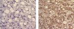 alpha-Fetoprotein Antibody in Immunohistochemistry (Paraffin) (IHC (P))