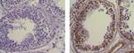 Cyclin E Antibody in Immunohistochemistry (Paraffin) (IHC (P))