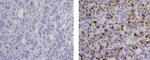 Progesterone Receptor Antibody in Immunohistochemistry (Paraffin) (IHC (P))