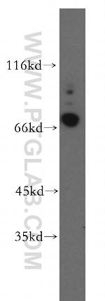 CRTAC1 Antibody in Western Blot (WB)