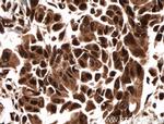 CUGBP1 Antibody in Immunohistochemistry (Paraffin) (IHC (P))