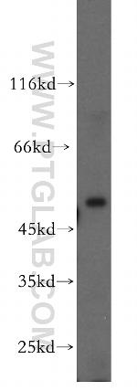 CUGBP1 Antibody in Western Blot (WB)