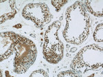 CUGBP1 Antibody in Immunohistochemistry (Paraffin) (IHC (P))