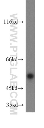 CUGBP1 Antibody in Western Blot (WB)