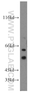 CUGBP1 Antibody in Western Blot (WB)