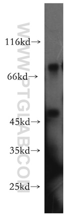 CUGBP1 Antibody in Western Blot (WB)