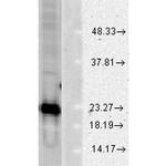 Superoxide dismutase (SOD) Cu/Zn Antibody in Western Blot (WB)